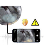 JEET QT360 Series All-Way Articulation Videoscope - Image 8